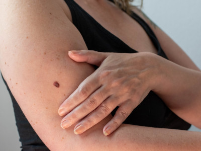 Онкологи назвали телесные сигналы о начале рака