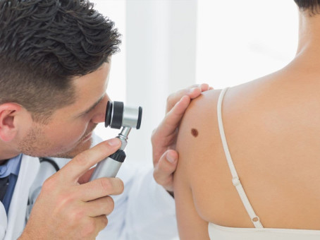 Почему стоит бояться родинок на шее