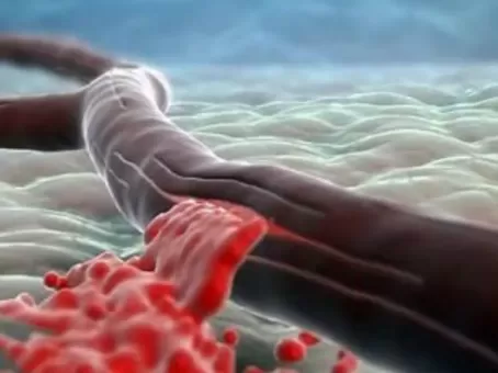 6 признаков надвигающегося инсульта: как тело предупреждает