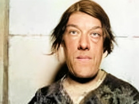 Трагическая история самой уродливой женщины в мире