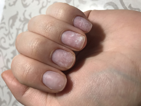 Безошибочные симптомы рака: характерны для любой онкологии