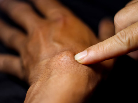 Признаки густой крови, их нельзя игнорировать ни в каком возрасте