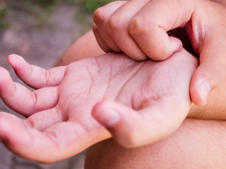 Признак близкого сердечного приступа проявится на коже