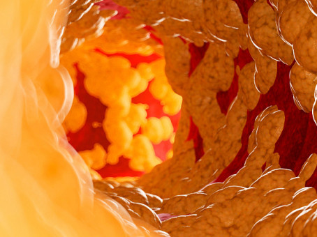 Этот фрукт — враг «плохого» холестерина: нужно есть ежедневно