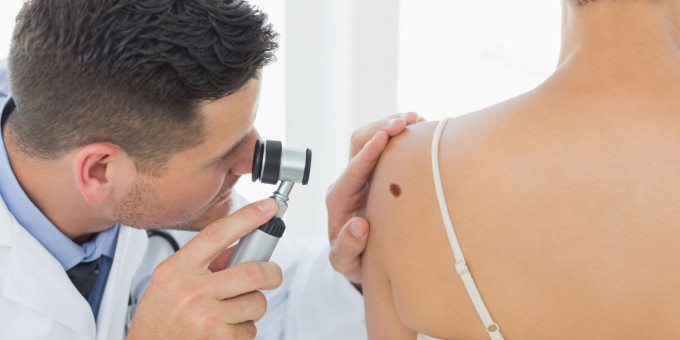 Почему стоит бояться родинок на шее