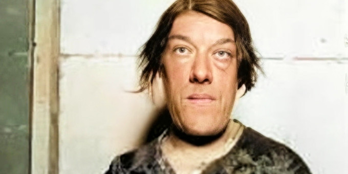 Трагическая история самой уродливой женщины в мире