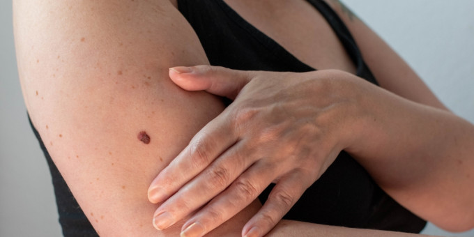 Онкологи назвали телесные сигналы о начале рака