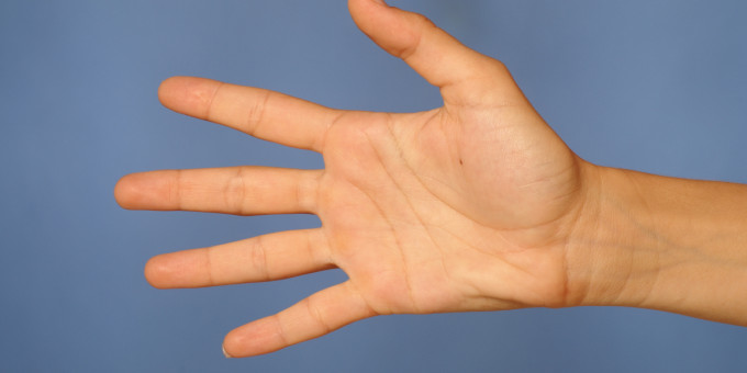 Вы уникальны, если у вас на ладони есть буква Х