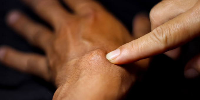 Признаки густой крови, их нельзя игнорировать ни в каком возрасте