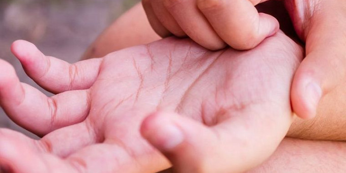 Признак близкого сердечного приступа проявится на коже