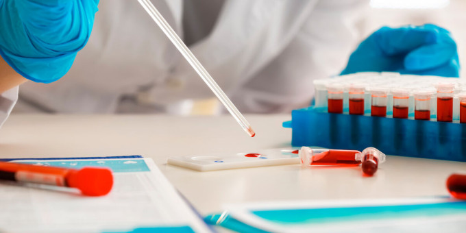 Какие продукты под полным запретом при густой крови