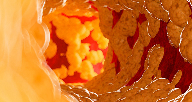 Этот фрукт — враг «плохого» холестерина: нужно есть ежедневно